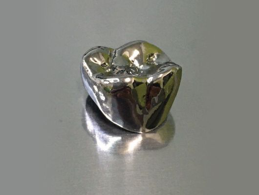 チタンクラウン